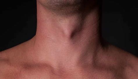 Pomo De Adão O Que É - Pomo de adão? O que é, para que serve, por que só os homens têm?
