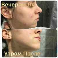 Дерматотропные средства МосФарма Суспензия "Циндол" | отзывы