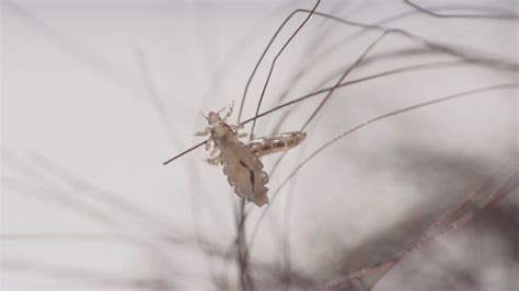 Human Head Lice on the human hair Stock Video Footage - Storyblocks