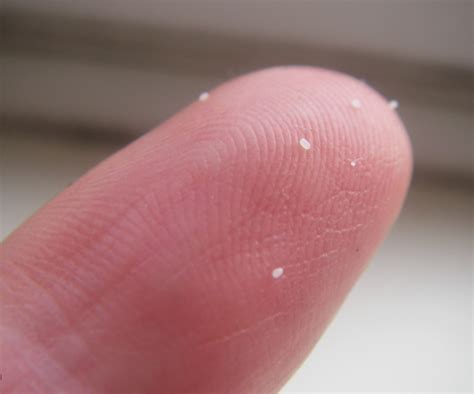 Unlocking the Lifecycle: The Frequency of Flea Egg Hatching – Flea Bites