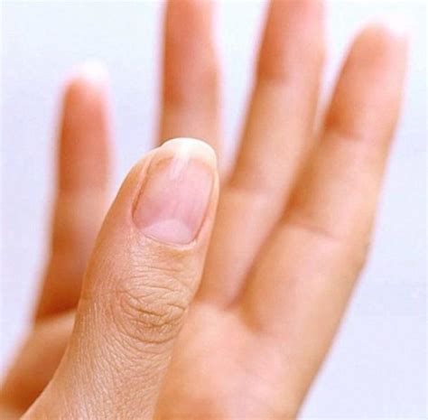 Порезать большой палец: примета и ее негативное воздействие