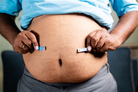 how long does it take to lose 80 lbs