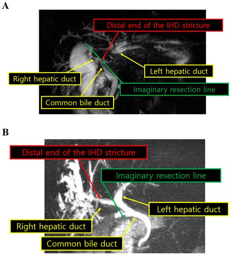 Development and Validation of a Difficulty Scoring System for