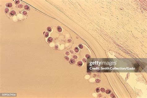 magnification   premium high res pictures getty images
