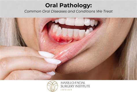 oral pathology common oral diseases  conditions  treat maxillo