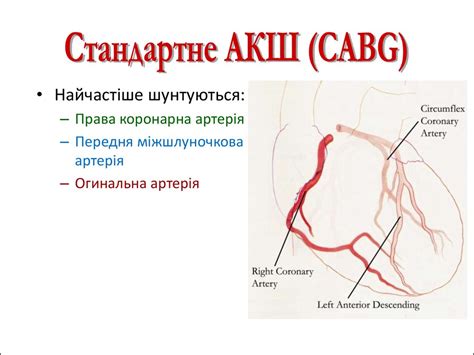 Аорто-коронарне шунтування - презентация онлайн