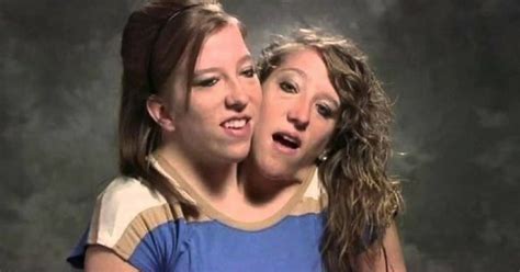 21+ Years After We Met Conjoined Twins Abby And Brittany, They Are All ...