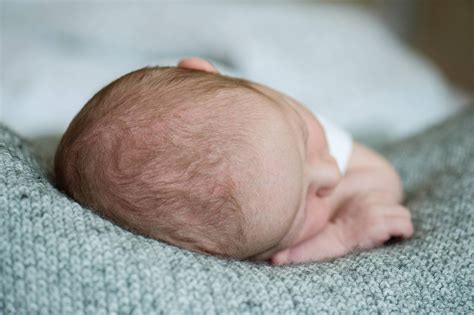 What is the Soft Spot on a Newborn's Head and is it Normal