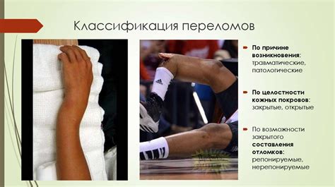 Хирургическое лечение переломов, особенности современной классификации ...
