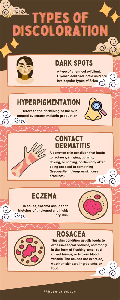 fix discoloration   face beauty tips
