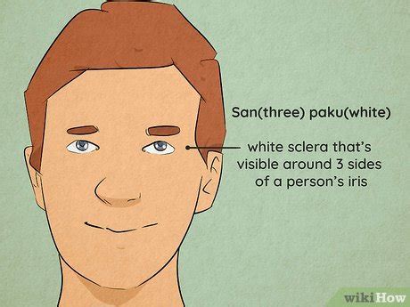 Sanpaku Eyes: History, Meaning & Likely Causes
