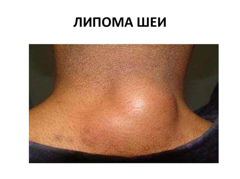 oncology - презентация онлайн