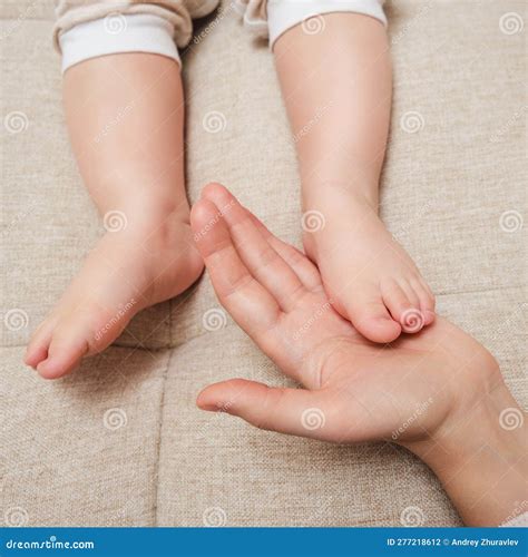 Deformed Toes on the Foot of the Toddler Baby, Congenital Curvature. Ki