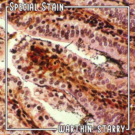 special stain warthin starry pathology  ponies