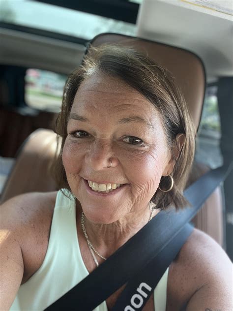 Semiglutide face-6 months later… : r/Semaglutide