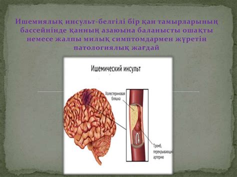 Ишемиялық инсульт. Этиология. Патогенез. Клиникасы. Диагностикасы. Емі ...
