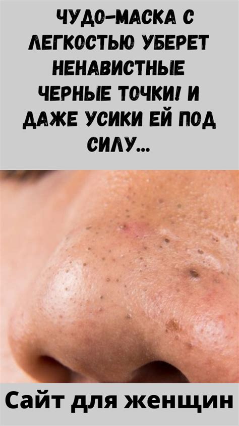 Сайт для женщин | Черные точки, Лечение прыщей, Чистое лицо