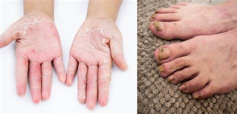 Dr Purva Skin Clinic
