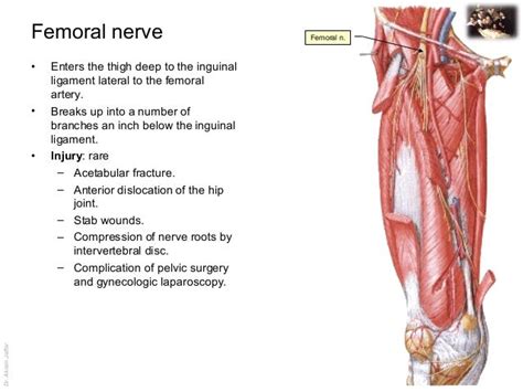 Applied anatomy femoral nerve injury