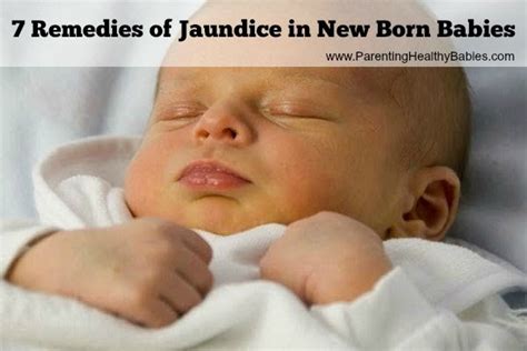 What Does Jaundice Look Like In Babies - What Does