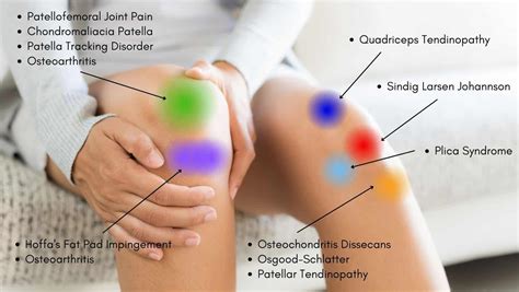 Knee Pain Location Chart | Learn the Pain Location of Knee Injuries