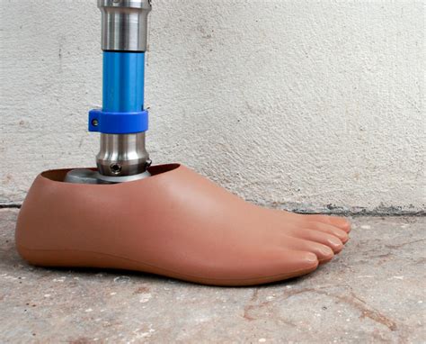 Diabetes Patients: Preventing Amputation