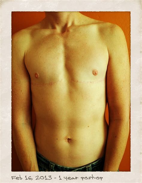 FTM | somewheretowardsblue