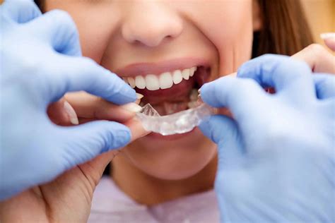 Mantenedor De Espacio Dental 6