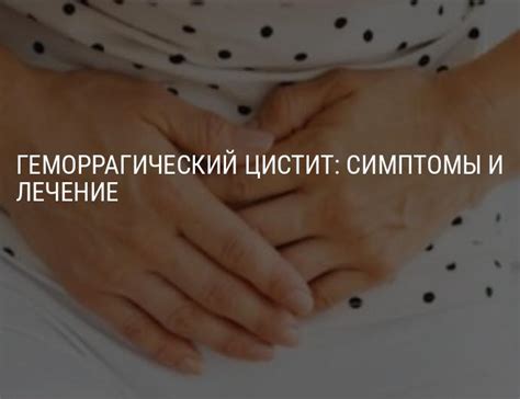 Геморрагический цистит: симптомы и лечение у женщин, детей и мужчин