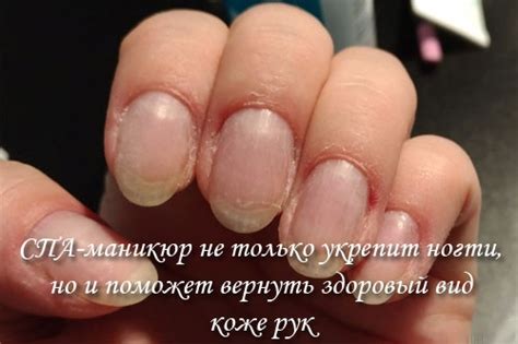 СПА маникюр и педикюр. Что это такое, фото, технология выполнения ...