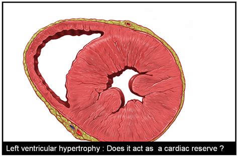 cardiac failure drsvenkatesan md
