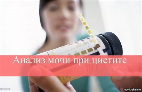 Анализ мочи при цистите | Moy-Kroha.INFO