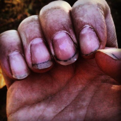 How To Clean Garden Dirt From Fingernails at Elma Thomas blog