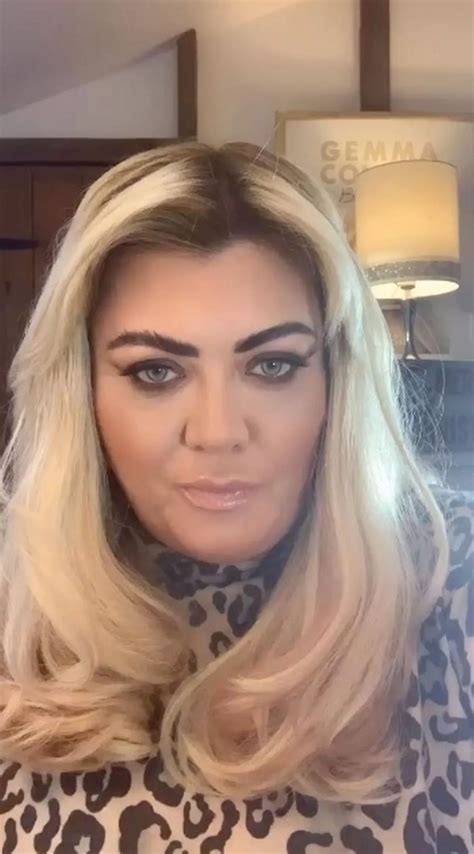 Gemma Collins shows off her 'real face' after having chin fat dissolved