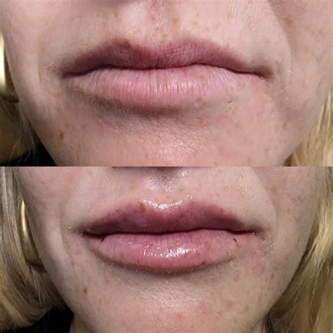UrLocalModel OnlyFans: Before & After The Leak