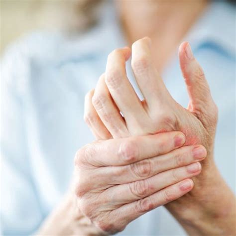 Psorijazni artritis – target terapija | MedicalCG Magazin o zdravlju i ...
