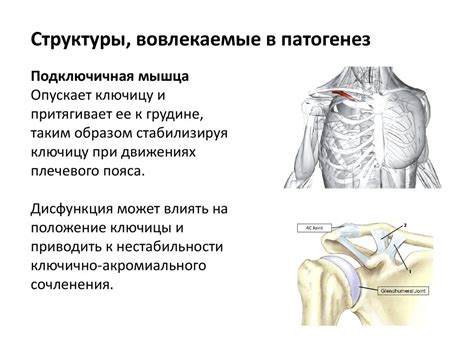 Плечелопаточный периартрит - презентация онлайн