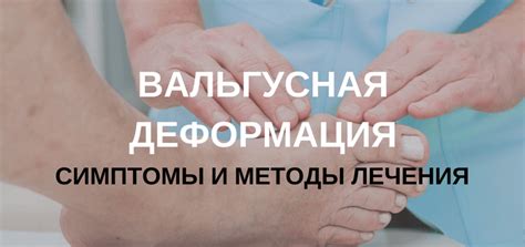 Вальгусная деформация большого пальца - Stopvalgus
