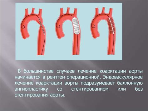 Врожденные пороки сердца - презентация онлайн