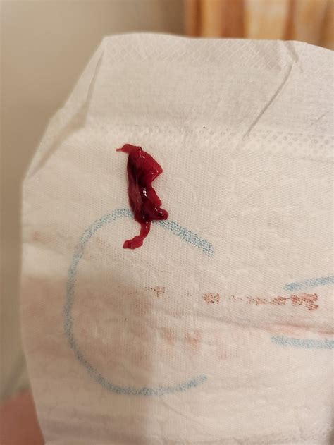 miscarriage graphic babycenter