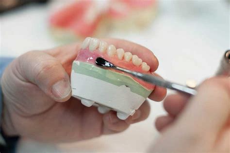 What Types of Denture Materials?