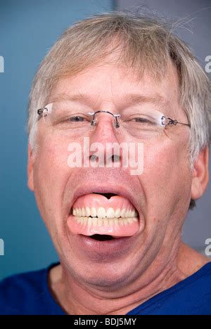 False teeth Stock Photo - Alamy