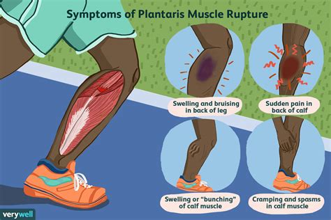 Calf Pain: Causes, Treatment, And When To See A Healthcare, 45% OFF