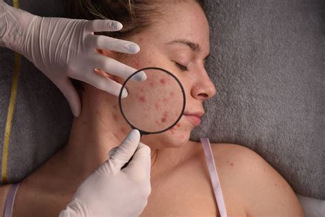 Dermatology Clinic - New Bern, NC - East Carolina Derm