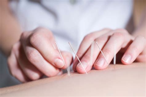 Acupuntura en los espasmos musculares | Esclerosis Múltiple Segovia