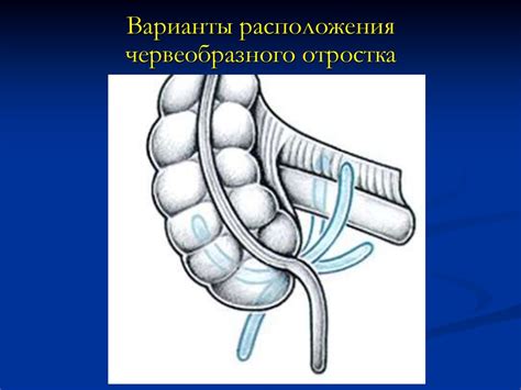 Острый аппендицит - презентация онлайн
