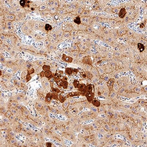 human clusterin antibody   systemsantibodiesprimary antibodies