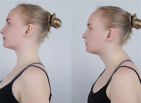 5 Neck Hump Exercises That Will Save Your Posture