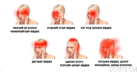 Толгой аль хэсгээрээ, яаж өвдөж байгаагаас хамаарч эрүүл мэндэд ямар ...
