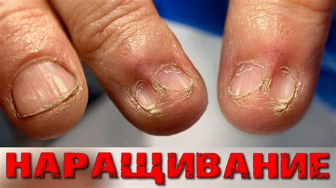 НОГТЯ НЕТ?!😨 Отпал..⚠️ ПРОТЕЗ из Кольца. Наращивание/ПРОТЕЗИРОВАНИЕ ...